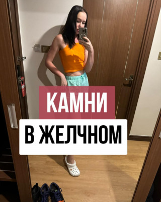 Камни в желчном пузыре и как их предотвратить?